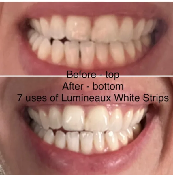 Lumineux Teeth Whitening Strips 7 Treatments5 jpg